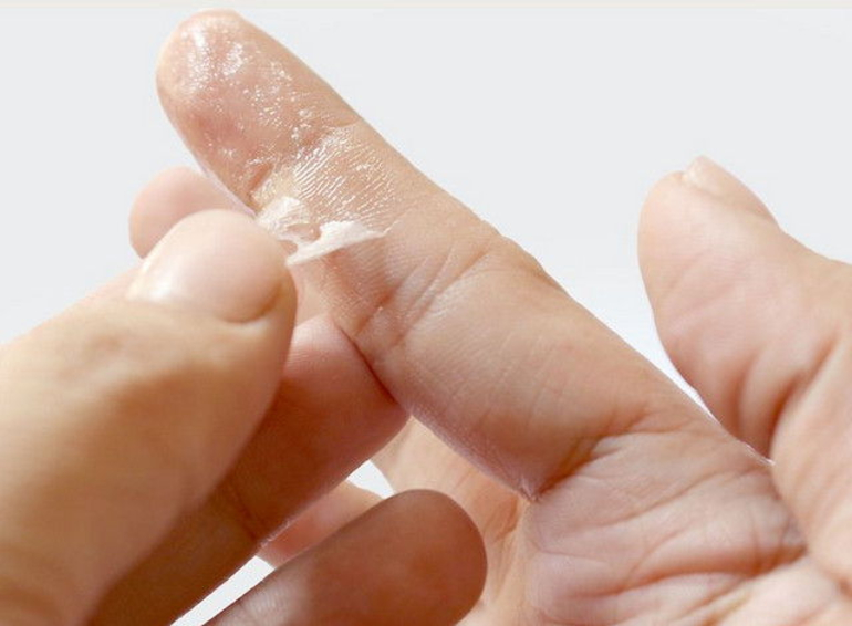 ลอกกาวช่วงเวลาจากมือ